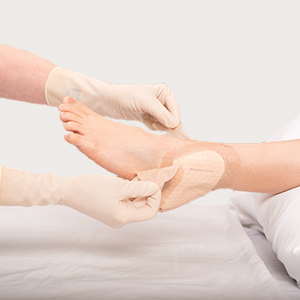 Mepilex Border Heel dressing for wound prevention and treatment | Mölnlycke